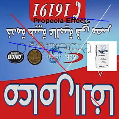 Achat finasteride propecia